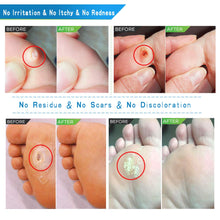 Load image into Gallery viewer, Corn Remover for Feet, Removes Callus, Goodbye to Footpain (42Pads)
